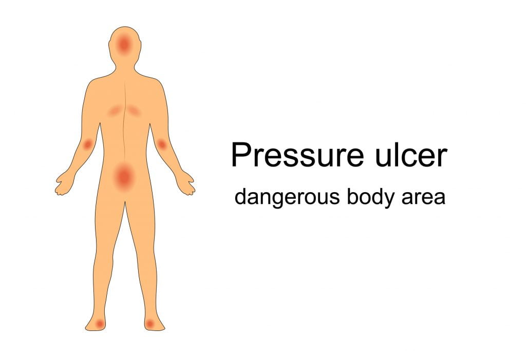 Personal and pressure care training